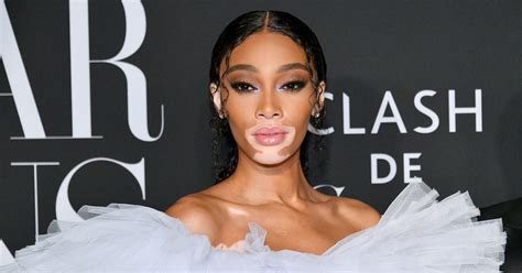 winnie harlow net worth|Winnie Harlow Net Worth 2024: From Runway to Riches